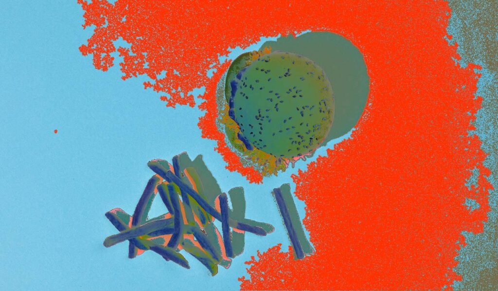 microplastics
